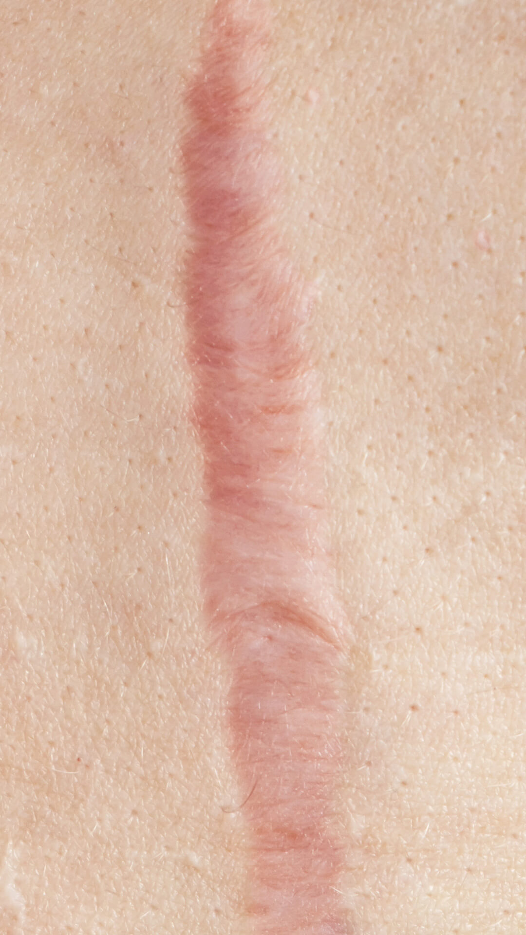 Curso Imunobiológicos - Para quem se destina 2